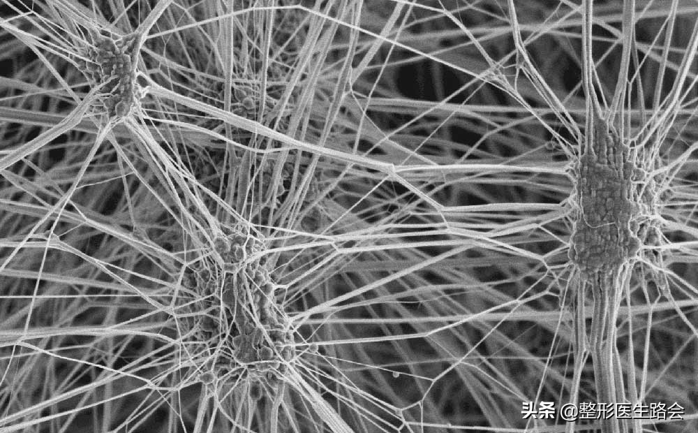 隆鼻三年后可以蹦极嘛,做了隆鼻到底可以蹦极吗