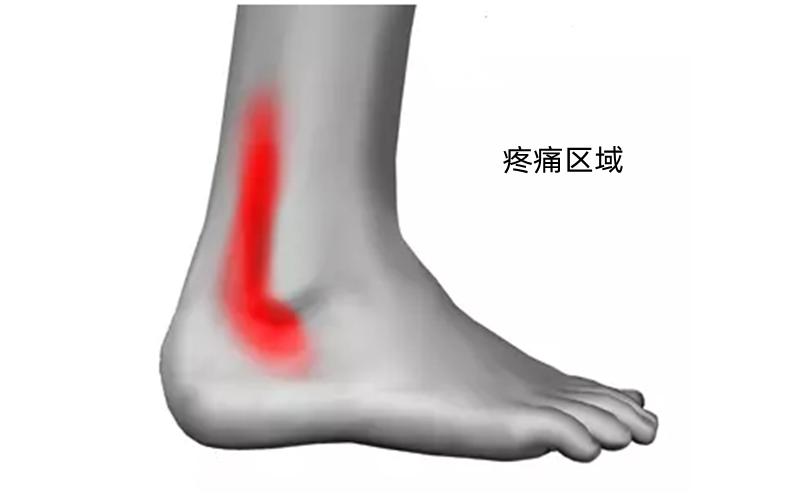 走路脚踝发出清脆响声突然很疼,走路脚踝发出清脆响声