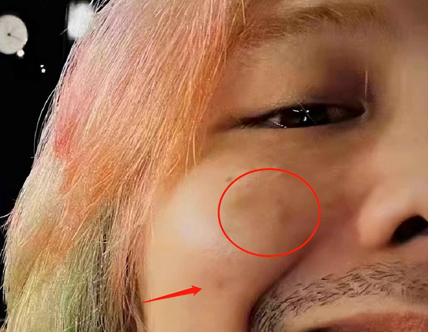 曾让杜海涛下跪的韩星又出辣眼造型！胡子拉碴，牙上还镶两颗彩钻