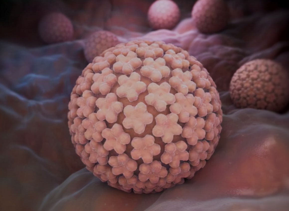 *裤内**是宫颈疾病的“感应器”？若*裤内**出现2种颜色，要多加注意