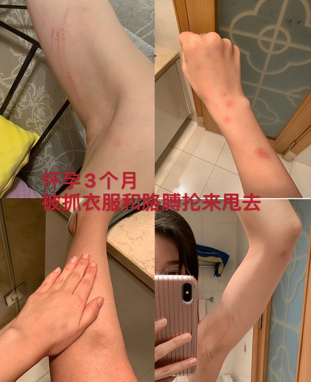 有家暴的运动员,有成绩没人品