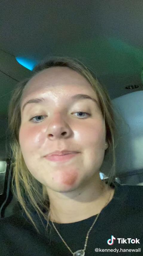 澳洲妹子和男友接吻,澳大利亚女子与男友接吻