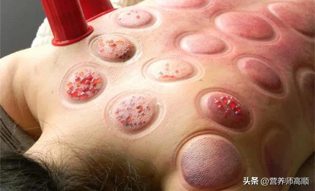 湿气要如何改善,湿气重怎么有效祛除湿气呢