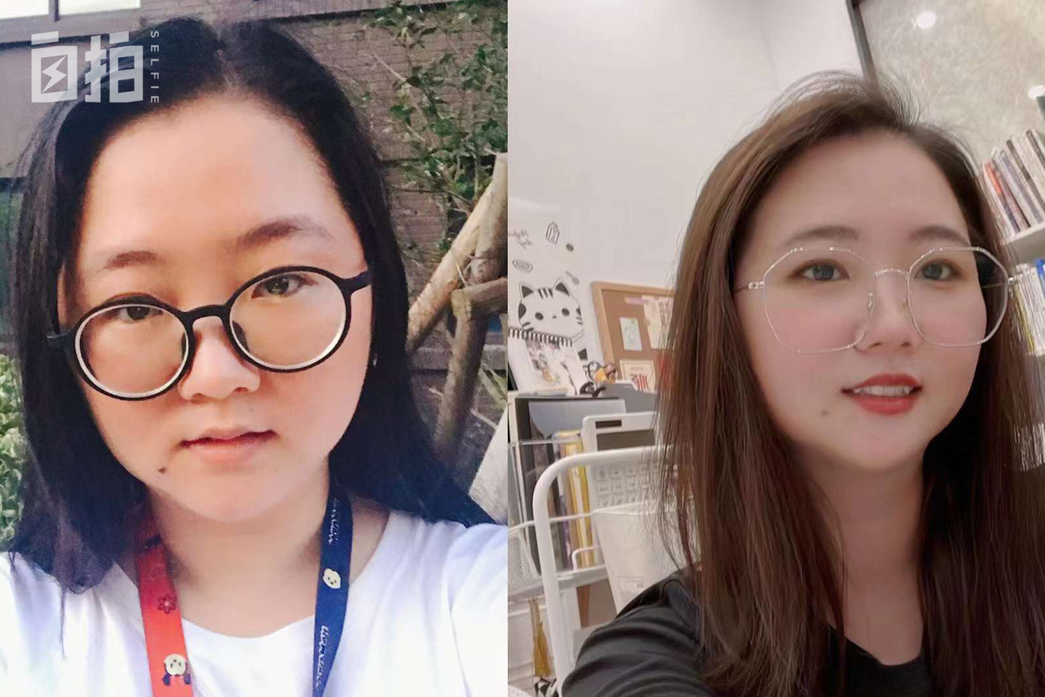 鍏堝ぉ鎬уけ鑱墜鏈垂澶氬皯,澶辫仾鎵嬫湳鎭㈠鍚姏