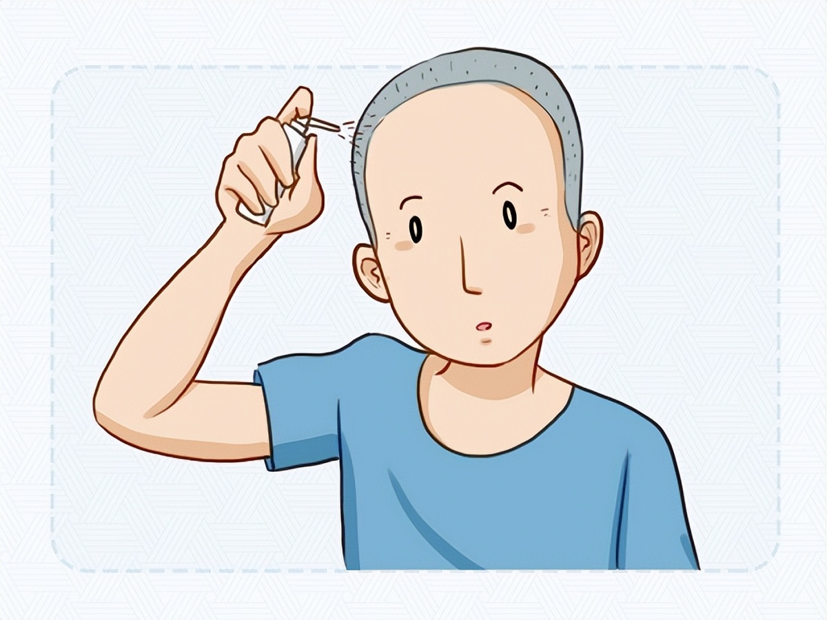 防脱生发洗发偏方,懒人生发最有效的办法