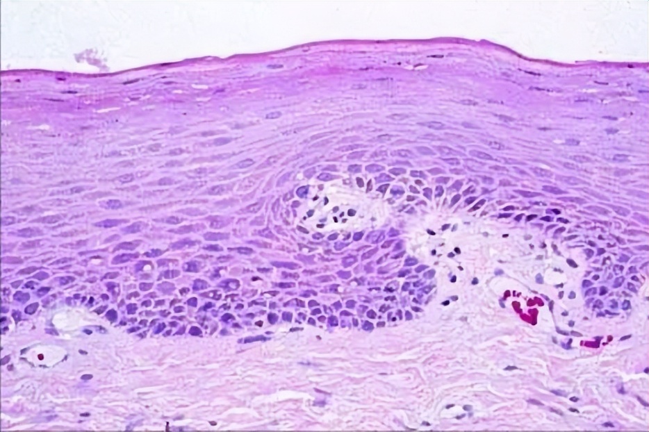 误食月经血怎么办,误食妇科药会怎样
