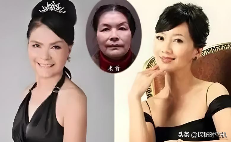 67岁英国太婆隆胸,67岁外国太婆隆胸