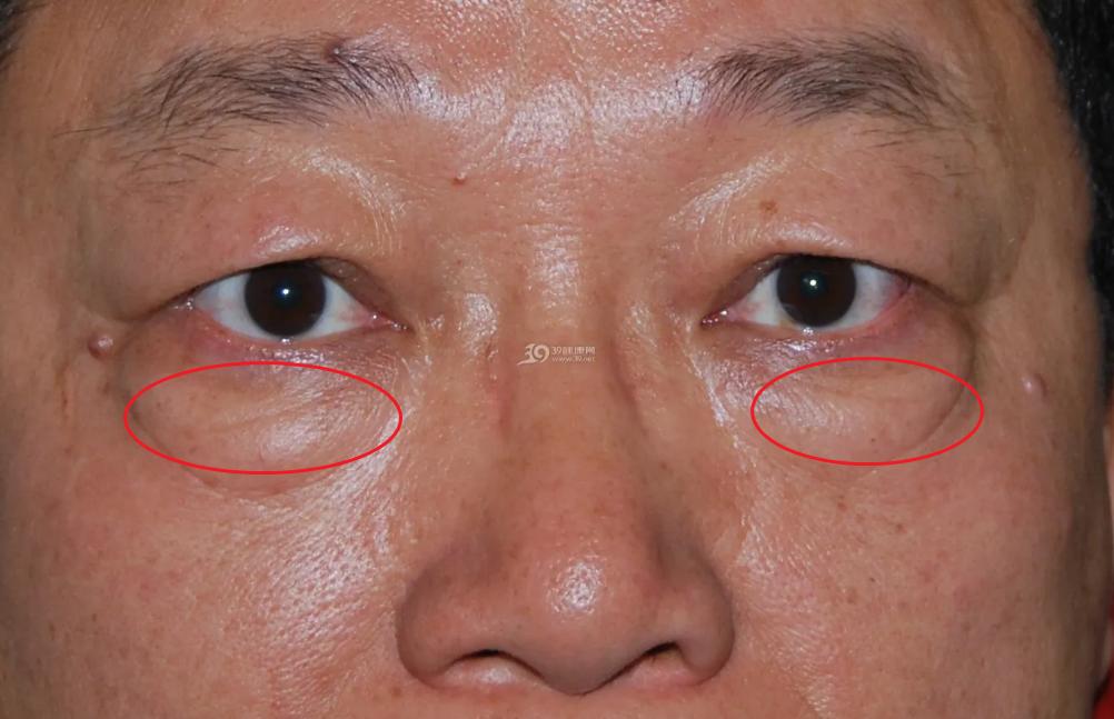 参苓白术散祛湿的秘籍找到了,参苓白术散调理脾胃祛湿