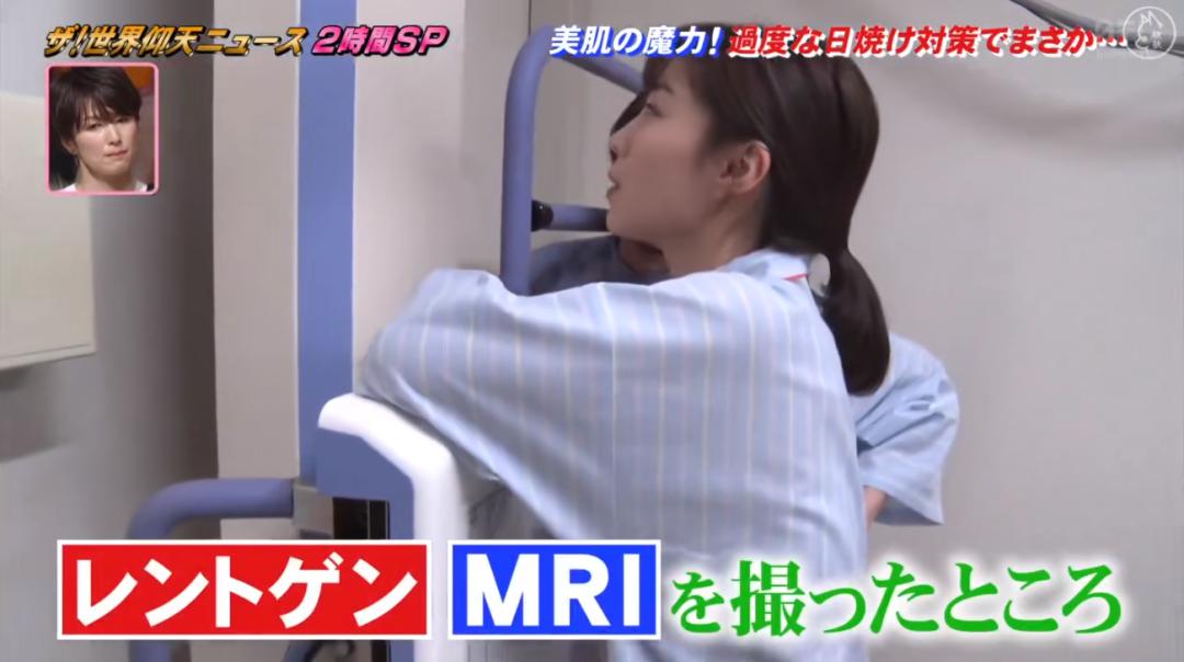 日本漂亮小姐姐不想被晒黑，每天全副武装！2年后身高竟缩水7cm…