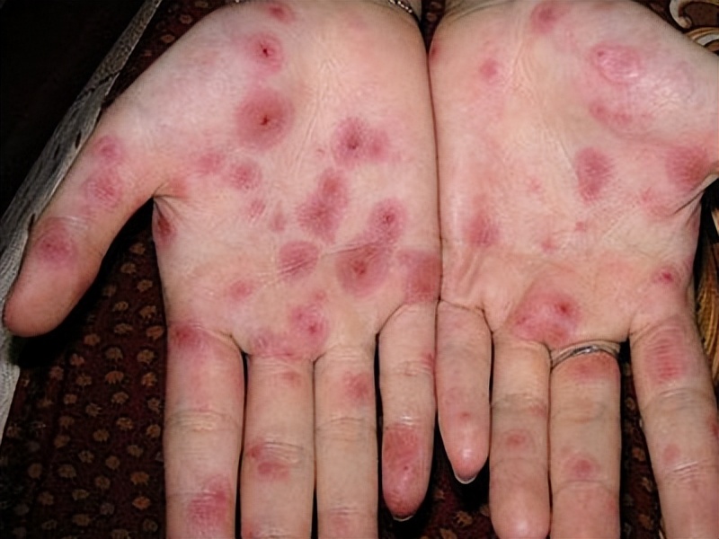 为什么男性会选择嫖娼？医生：嫖娼传播5种性病，私生活别太放纵