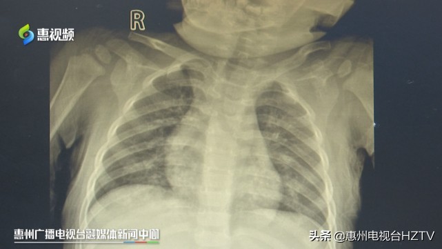 吃进有毒物质如何解毒,祸从口入