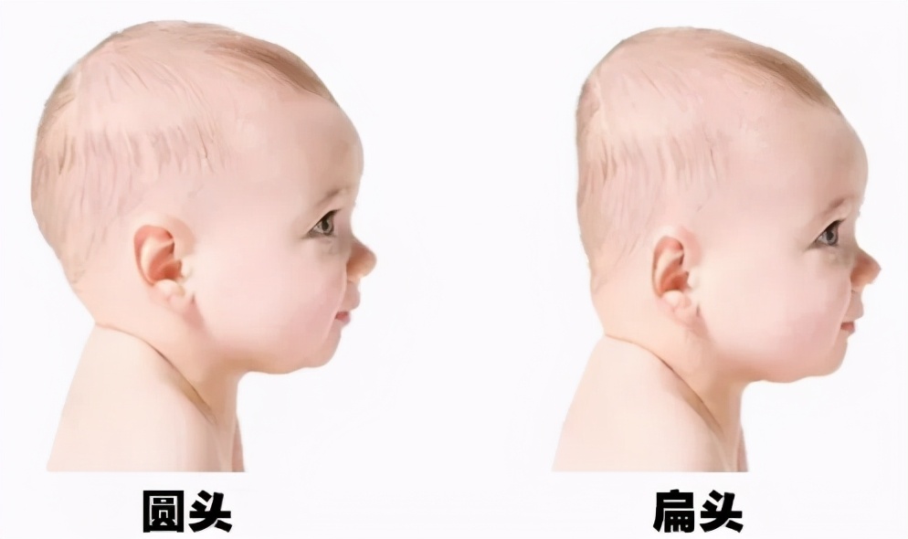 儿童应该睡枕头还是不睡枕头,从小睡枕头与从不睡枕头的娃