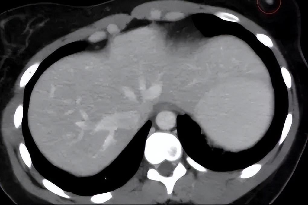 没有月经没有子宫是石女吗,没有生育能力的女人是石女吗