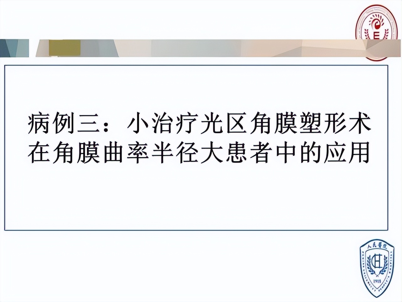 王凯角膜塑形镜原理,王凯医生塑形镜