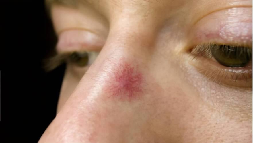 养肝护肝的药物和食物,养肝护肝的食物胡萝卜