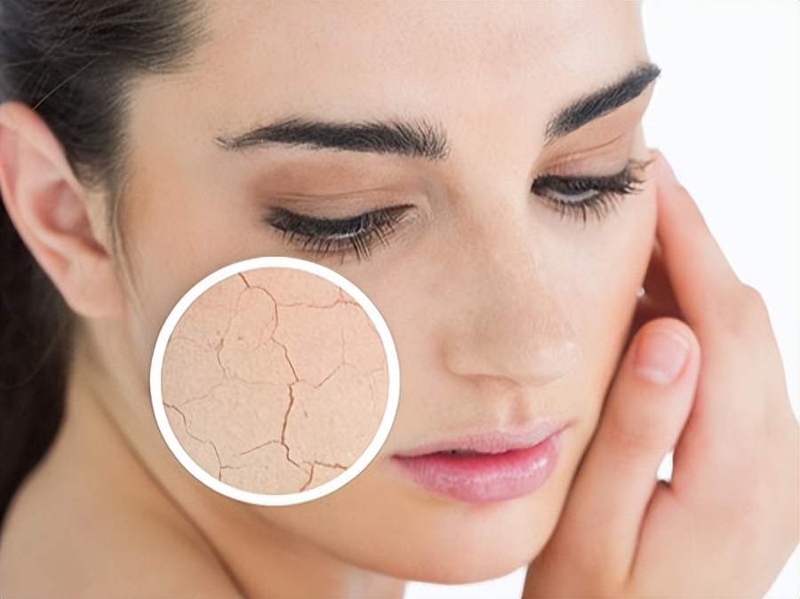 皮肤干燥紧绷怎么食疗,皮肤干燥紧绷怎么办