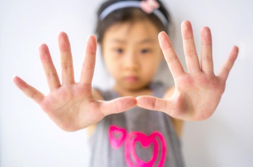 小孩手指割了一个很深的口子,小孩手上割一个小口子就好了