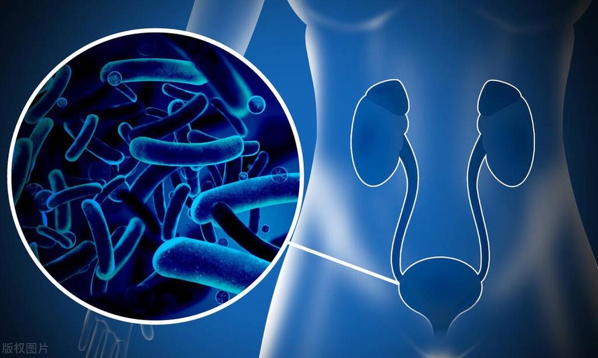 怎么避免间质性膀胱炎,腺性膀胱炎要注意什么避免复发