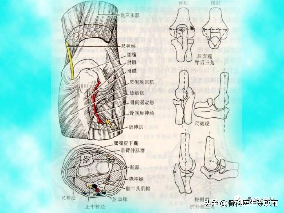 肘关节恐怖三联征最新治疗方法,肘关节恐怖三联征最佳治疗方法