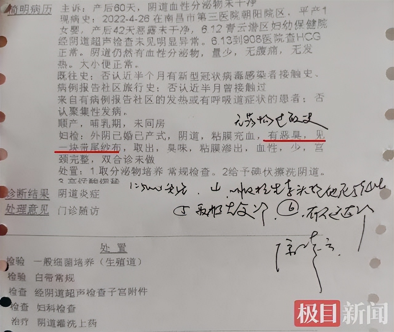 顺产60日后，南昌一女子体内有纱布遗留，卫健委：助产护士失误