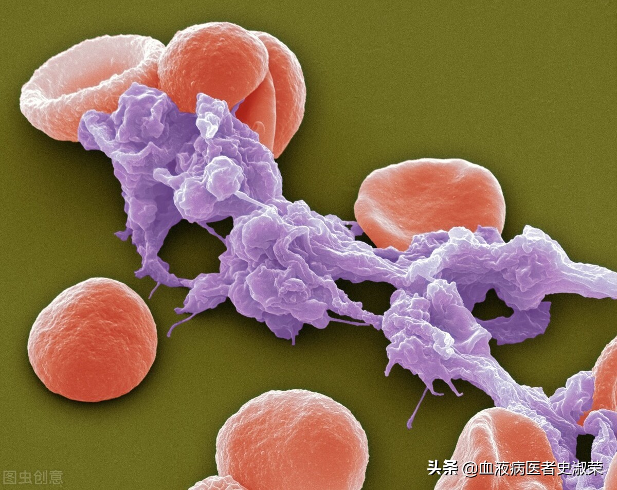 血小板减少为什么这么难治疗,宝宝免疫性血小板减少总是反复