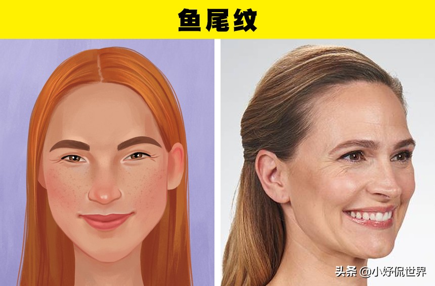 脸上有3种皱纹可能是健康的预警,皱纹跟情绪有关系吗