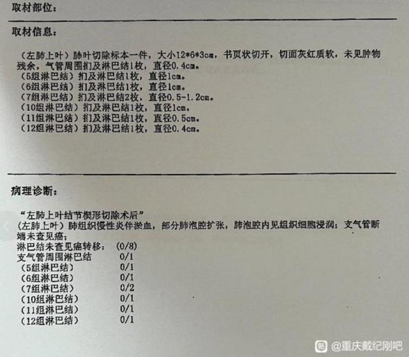 3个月内磨玻璃结节,多发磨玻璃结节3个月后减少