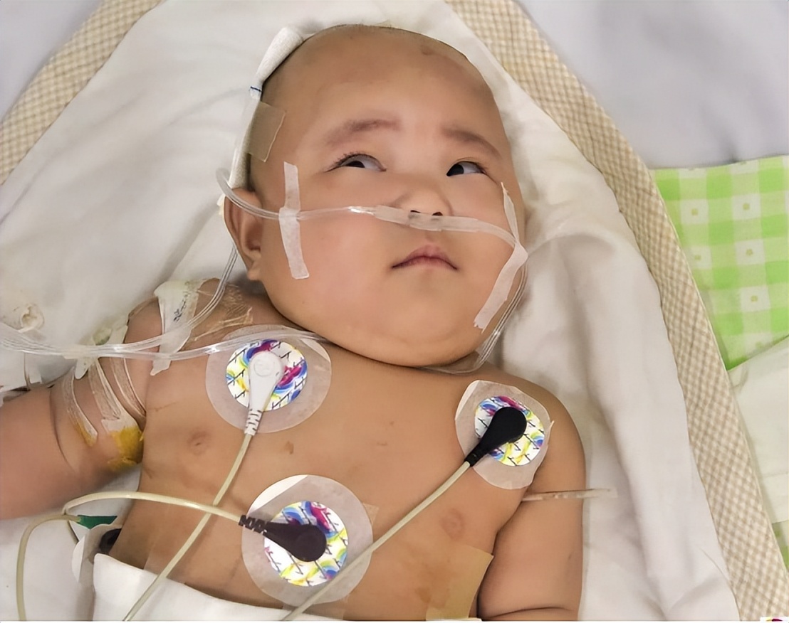 新生儿呼吸衰竭病例分析题,新生儿呼吸衰竭是什么原因引起的