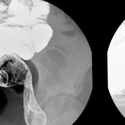 小男孩蹲在卫生间不出来,小男孩8岁小便老是上不出来