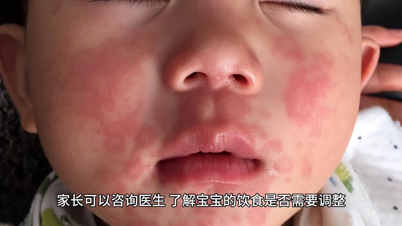 宝宝流口水特别严重怎么办,宝宝流口水严重怎么解决