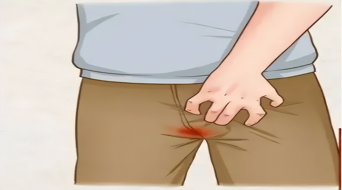 为什么会出现肛裂这样的情况,肛裂为什么女性居多