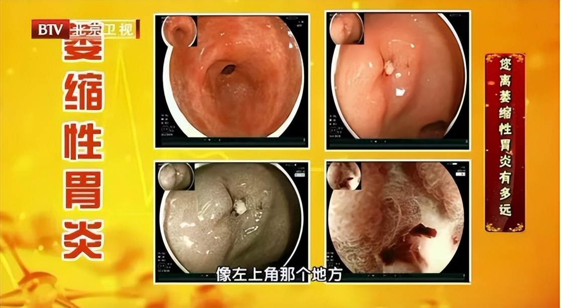 天然叶酸好不好,天然叶酸利用率高还是低