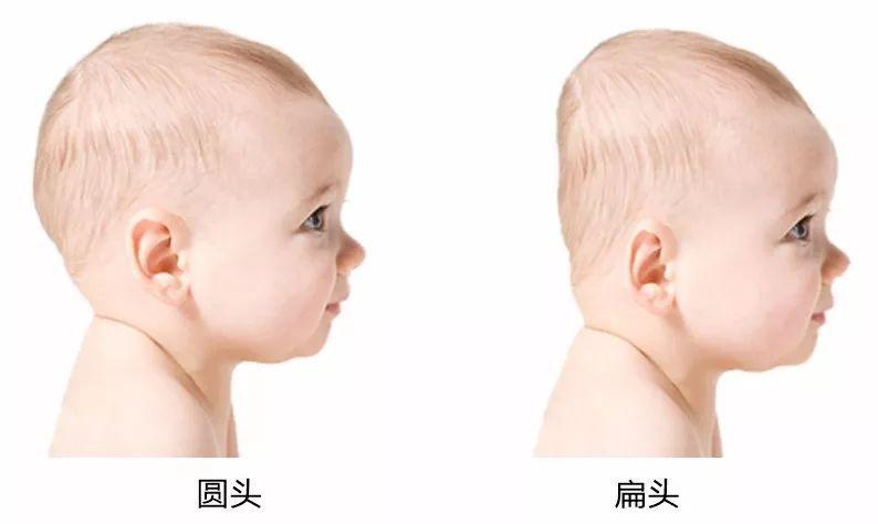 孩子睡枕头高会驼背吗,孩子睡大人枕头后果