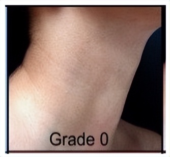 不要让颈纹出卖了你的年纪,不要让颈纹出卖你的年纪