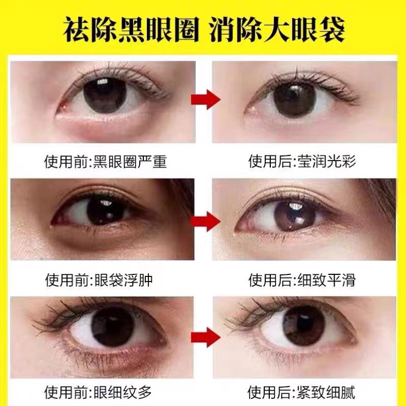 郑明明眼霜老款好用还是新款,郑明明眼霜国货推荐