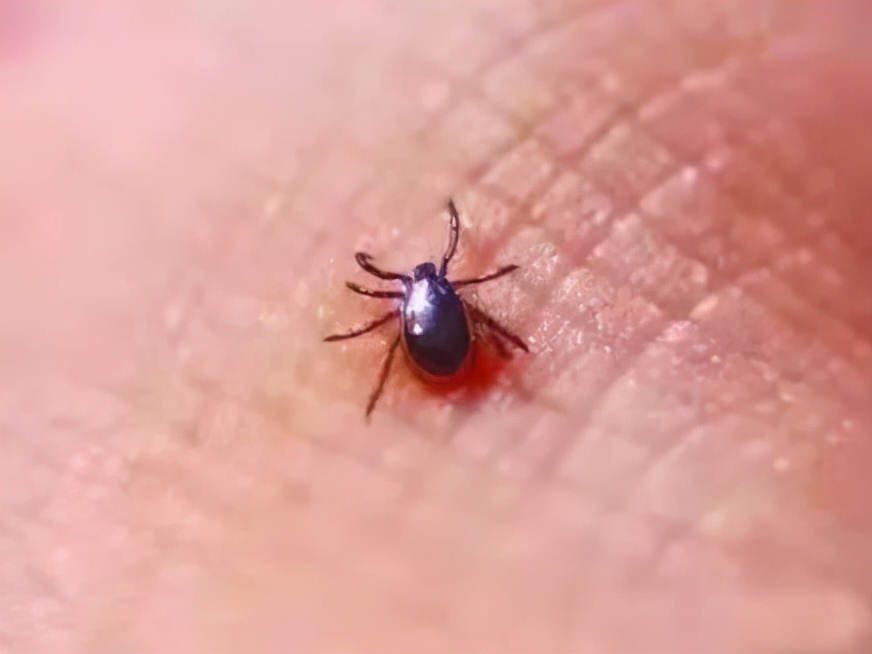 撸猫惹上虫子的早期症状,撸猫需谨慎担心猫抓病