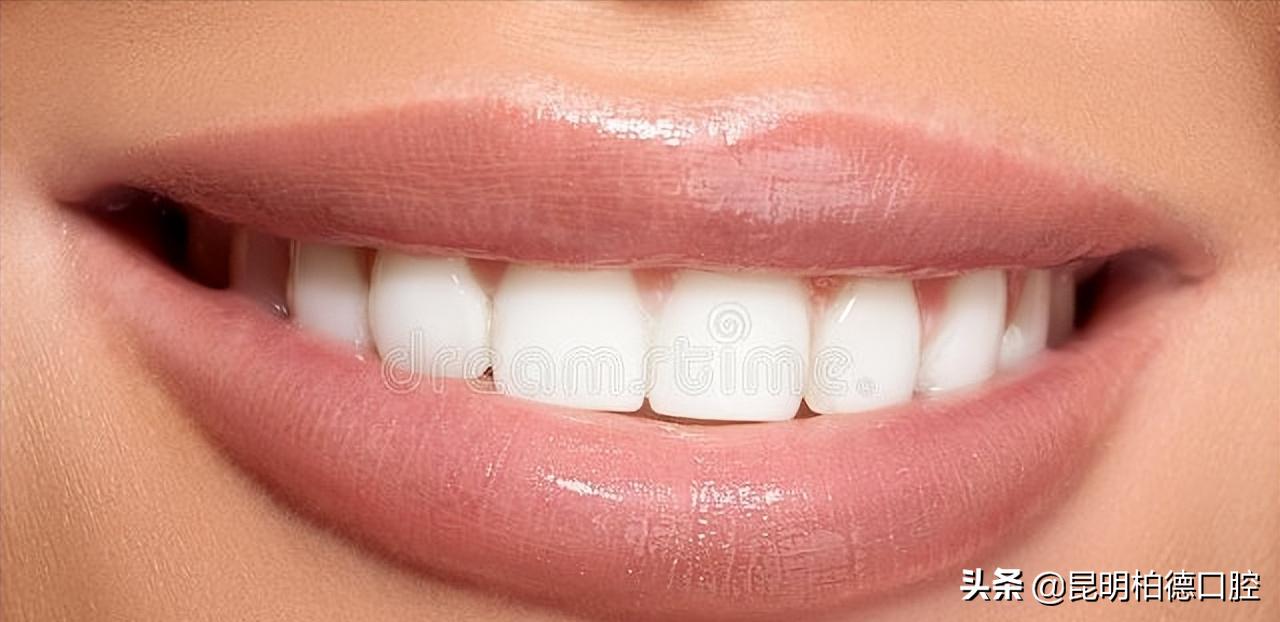 烤瓷冠牙龈变黑,全瓷冠边缘发黑怎么回事