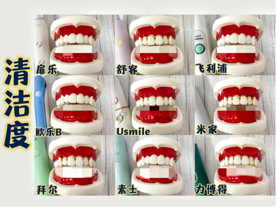 2023扉乐电动牙刷测评,usmile和飞利浦电动牙刷吐槽测评