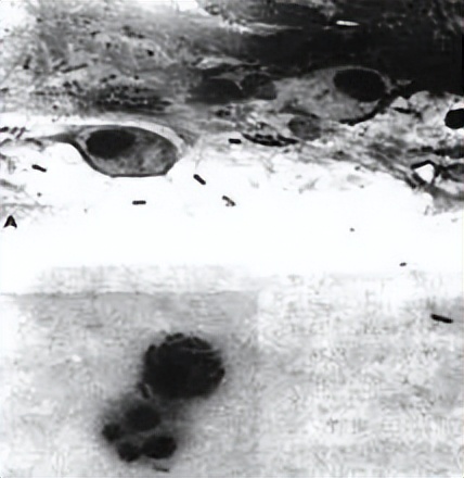 结膜炎畏光流泪还有点模糊怎么办,眼睛怕光迎风流泪结膜炎