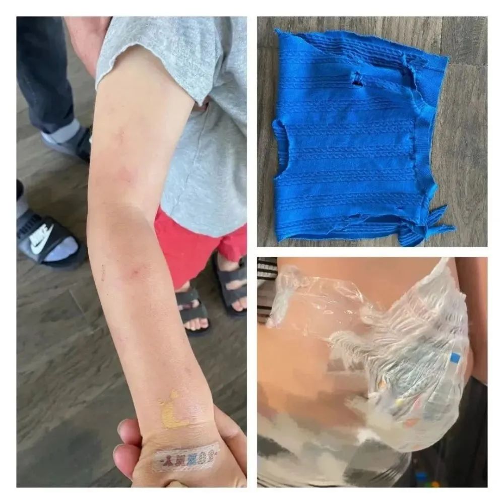 郑爽被曝剪手指、烟头烫孩子，这回彻底疯了？