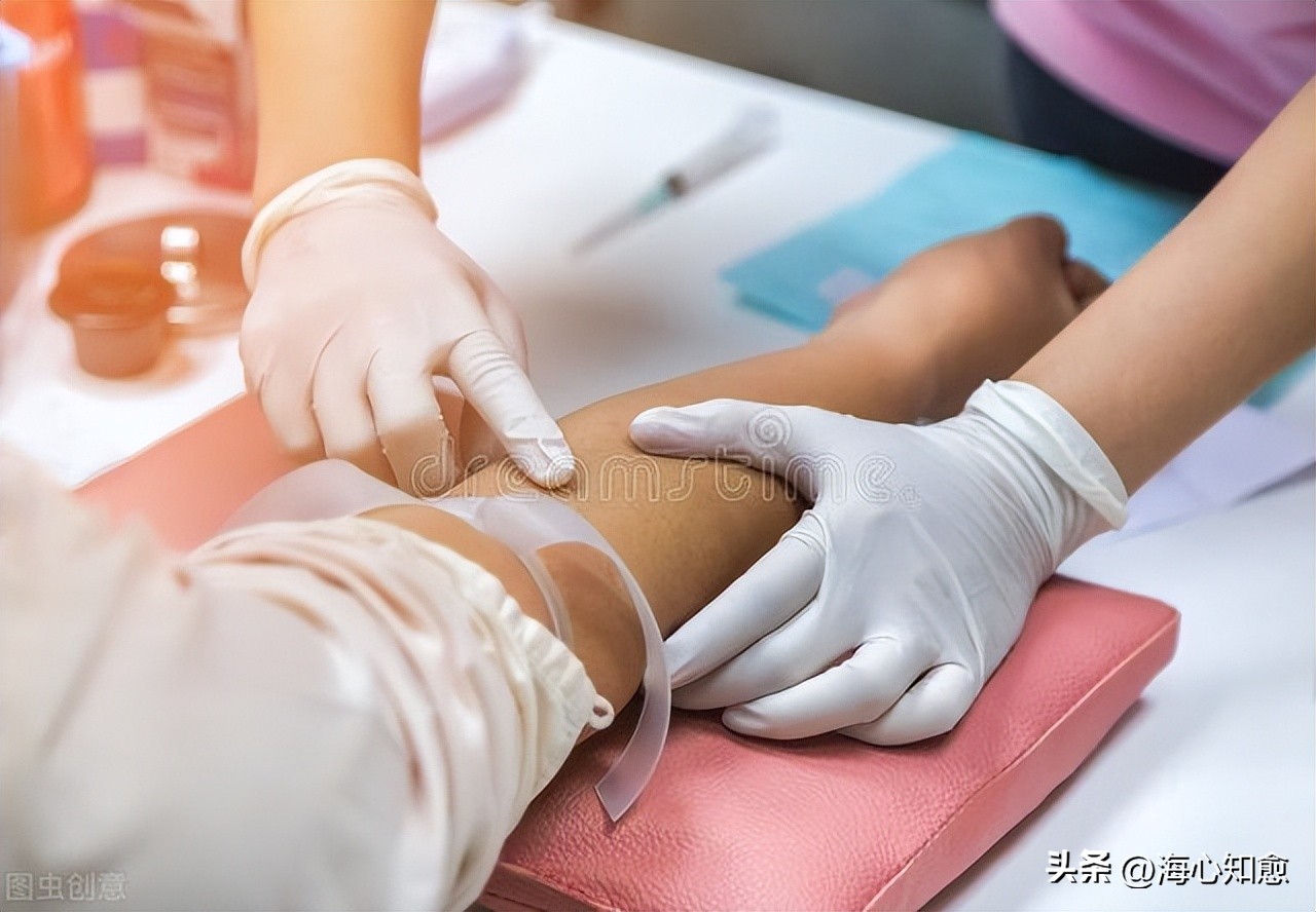 病理诊断初步考虑为恶性肿瘤,病理检查考虑恶性肿瘤是什么意思