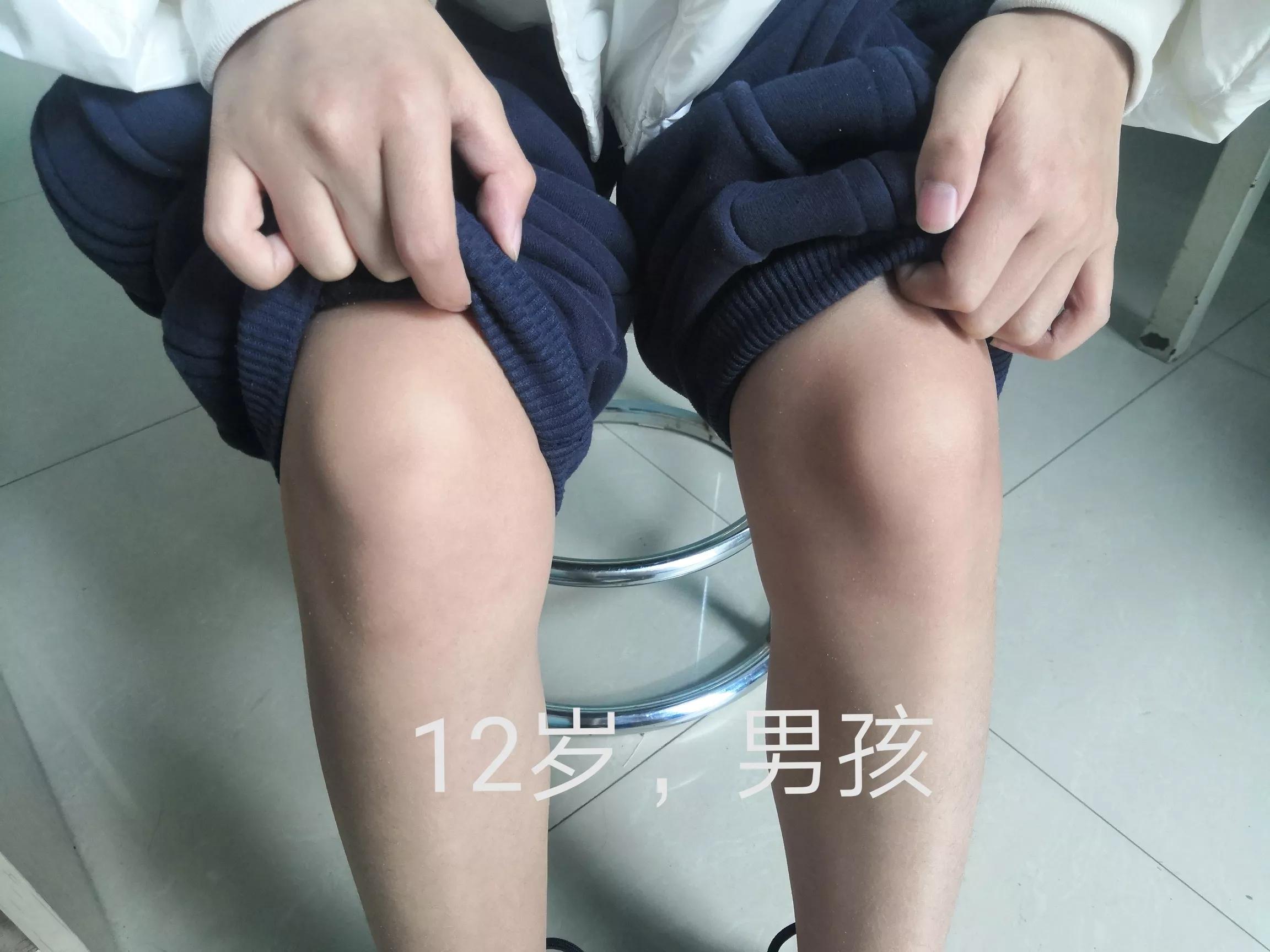 孩子膝盖疼和成长有关系吗,8岁孩子腿膝盖疼怎么回事
