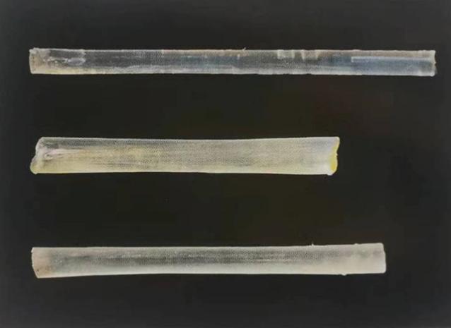 口腔纤维桩优点与缺点,口腔打纤维桩的条件