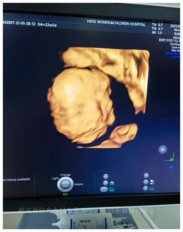 孕23周四维彩超看心脏吗,孕23周四维彩超能看到什么