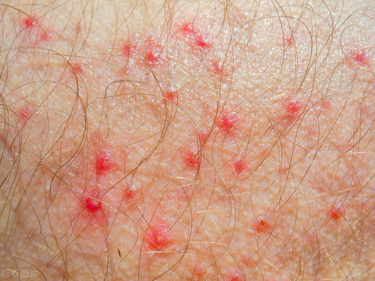 误食女性下面的分泌物对健康有影响吗？这些危险行为要知道