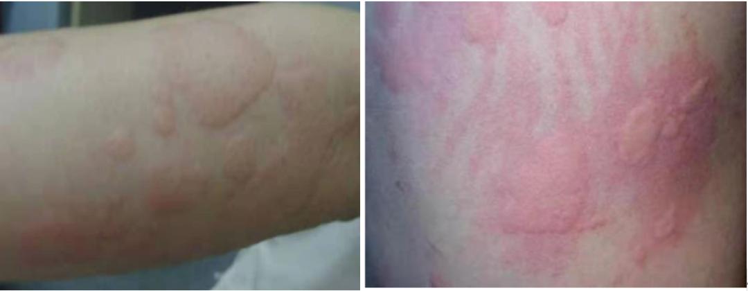 赵小侨为什么胎停,赵小侨早产