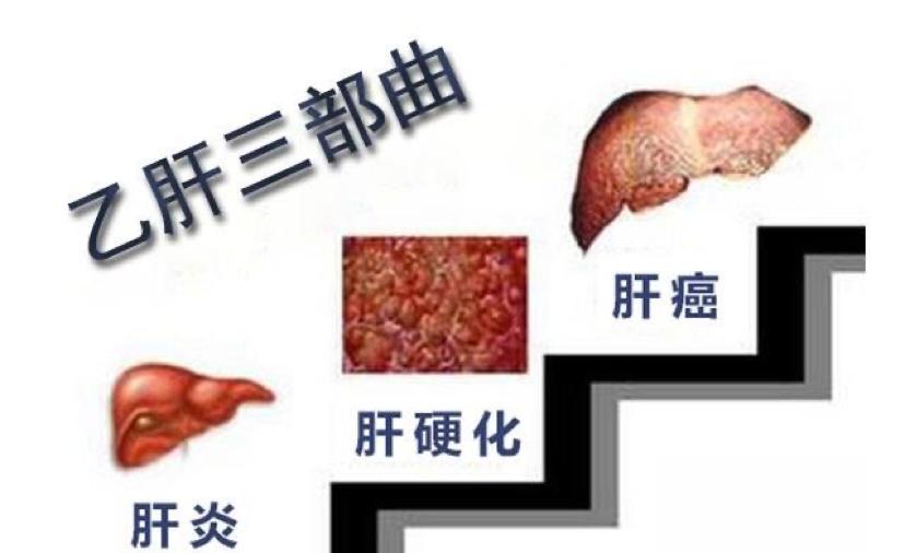 乙肝患者出现什么症状得注意,乙肝患者需要引起重视的情况