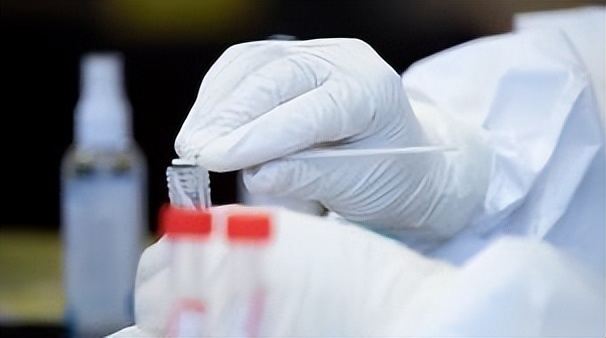 疫情放开后感染了怎么都有症状,疫情阳性前期会出现什么情况