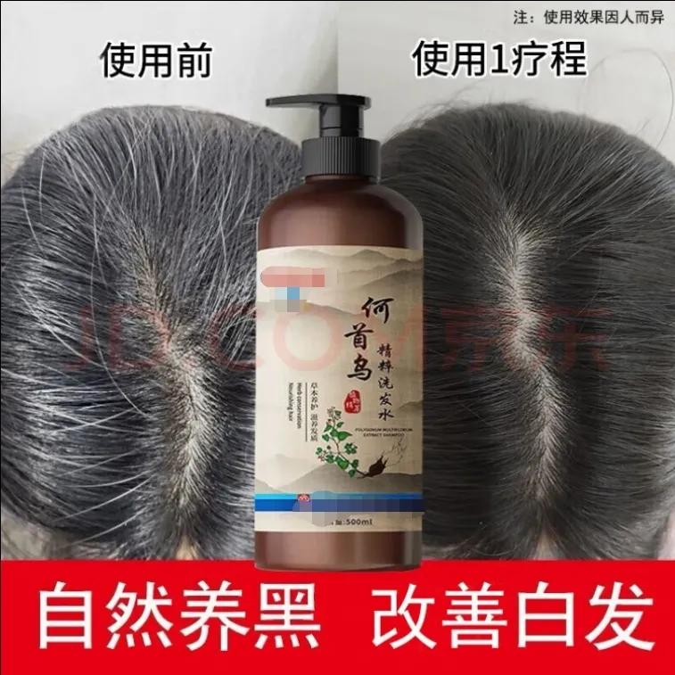 怎样改善白头发50岁,30岁白头有什么治疗方法吗