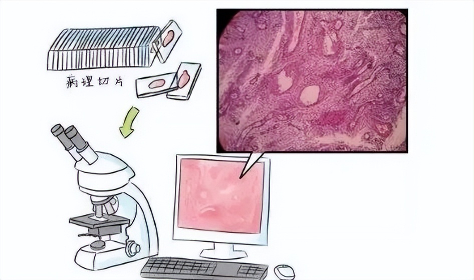 女性查hpv做哪些检查,男性hpv检查二甲医院可以查吗